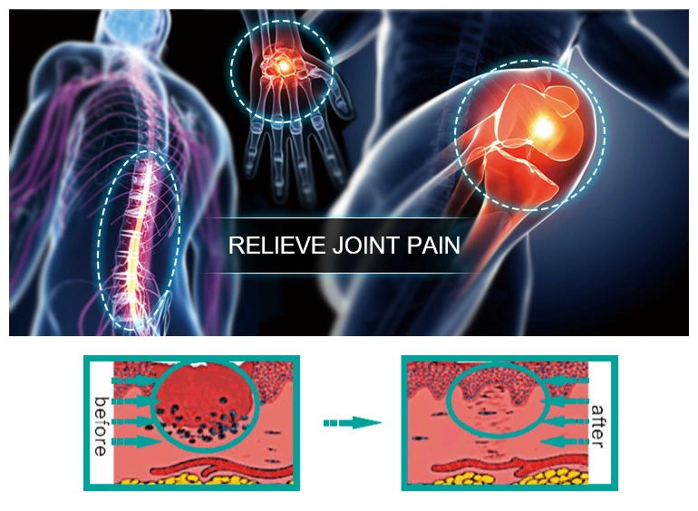 Low Level Cold Laser Therapy Physiotherapy Machine Pain Relief Device for Pain